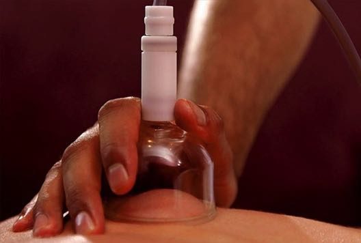 Schröpfgläser für die Saugwellenmassage